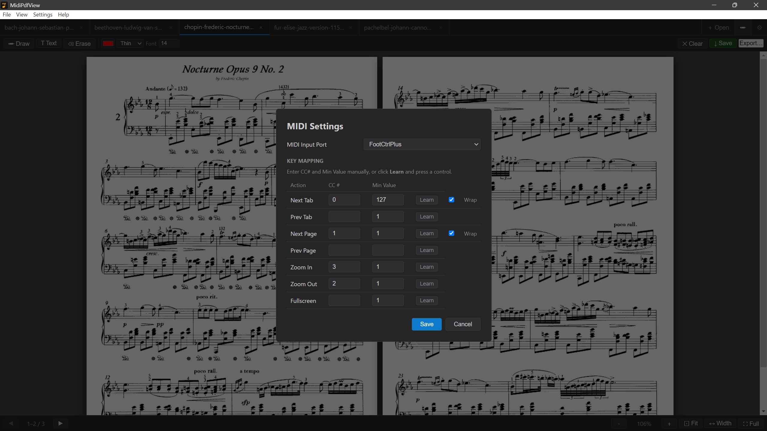 MIDI controller settings panel — assign any pedal button to any action